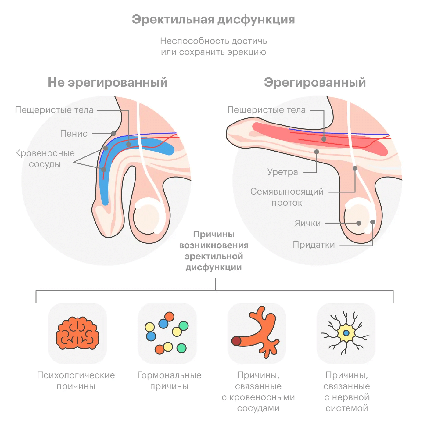 Как выглядит эректильная дисфункция у мужчин