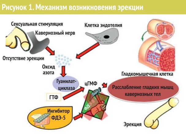 Эректильная дисфункция
